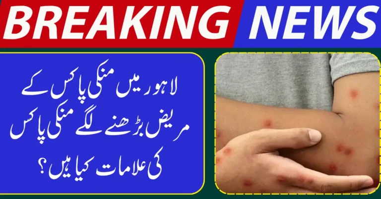 Monkeypox Cases Rise in Lahore, Health Authorities Urged to Act